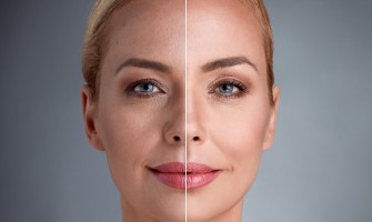 Tip 1 Kolajen: Ne İşe Yarar?